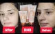 BNB Rice Facial Kit 3 in 1